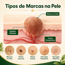 Adeus Verrugas Creme [COMPRE 1 LEVE 2] + Frete Grátis